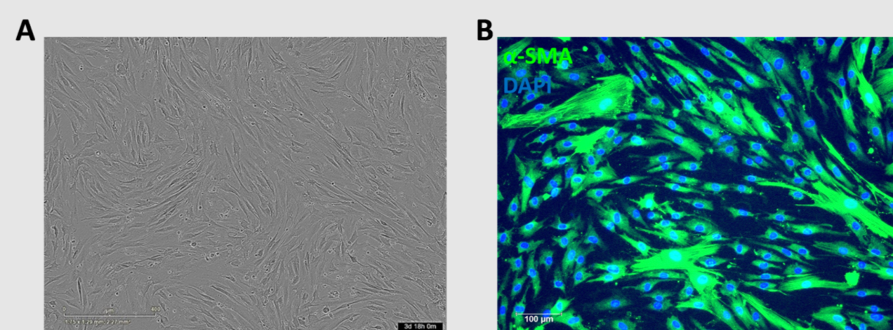 Human_Brain_Vascular_Pericytes.png