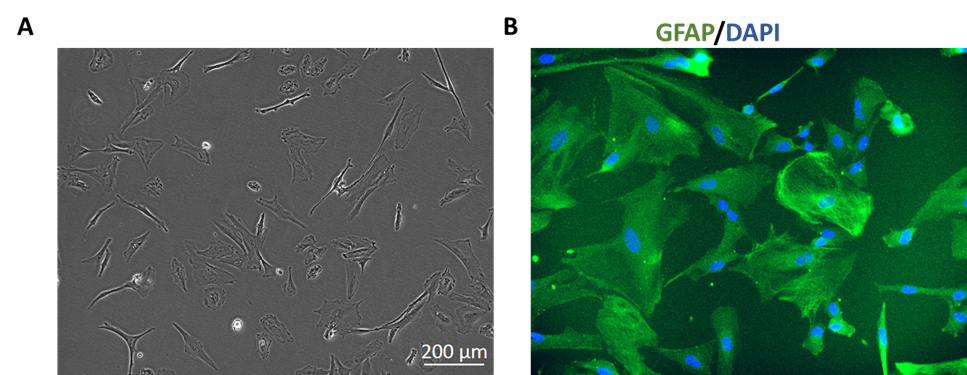 Human_Astrocytes_HAjpg.png