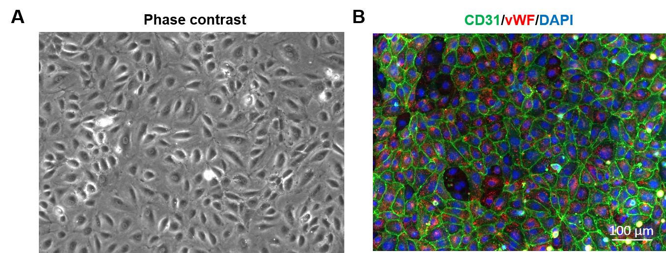 Human_Brain_Microvascular_Endothelial.png