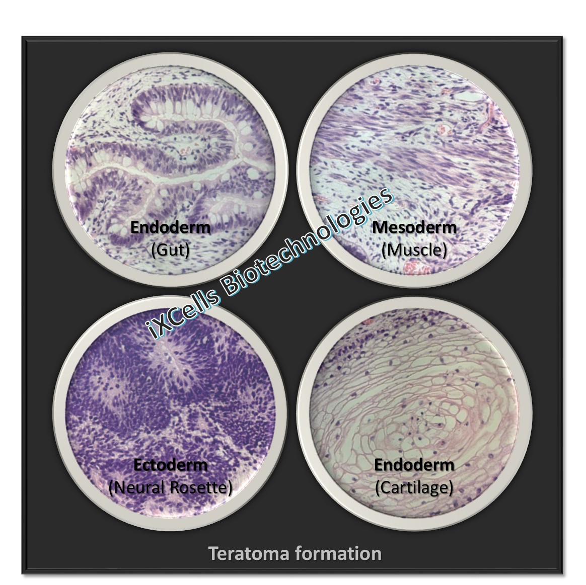 Teratoma formation.jpg
