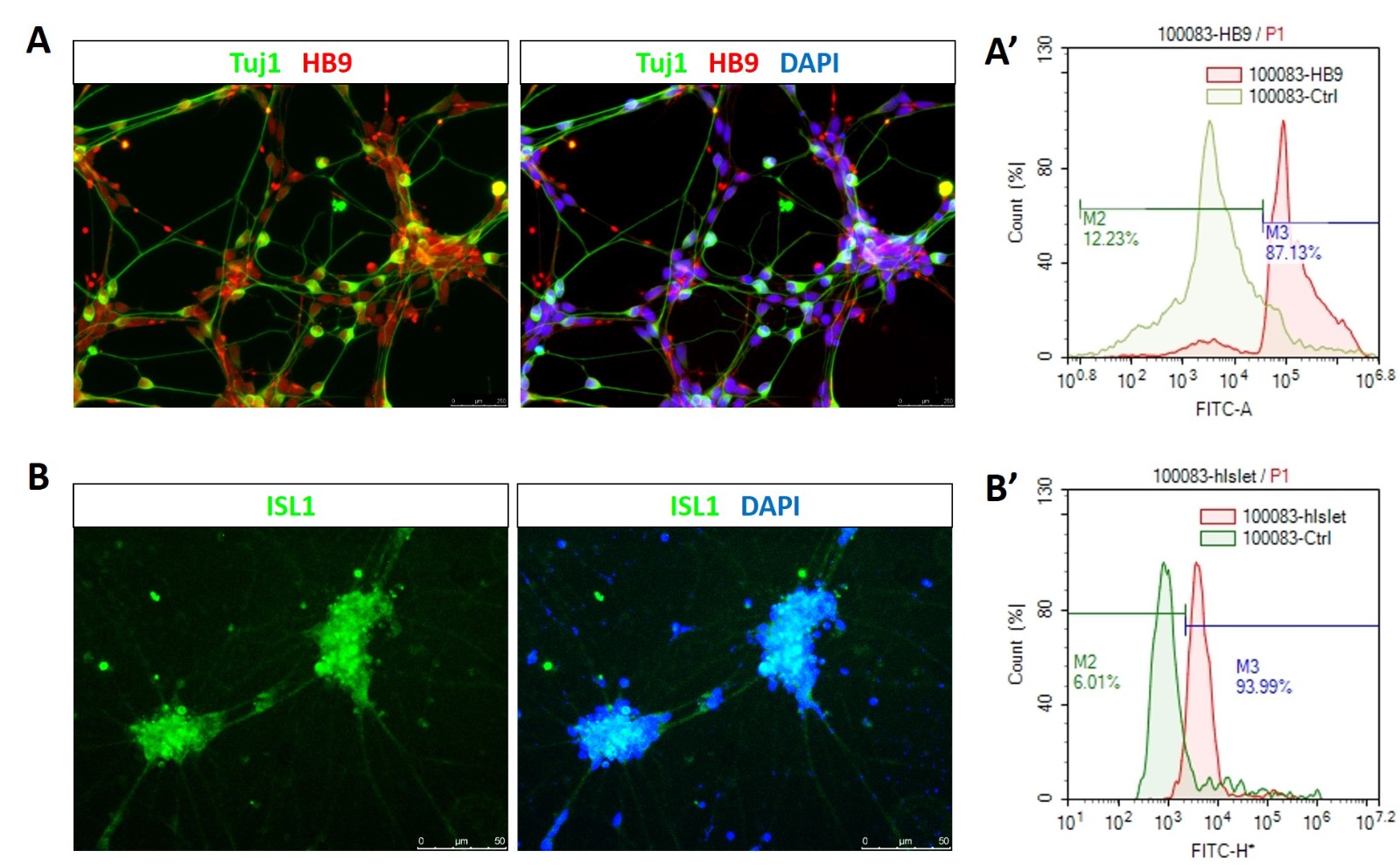 Motor neuron-1.jpg
