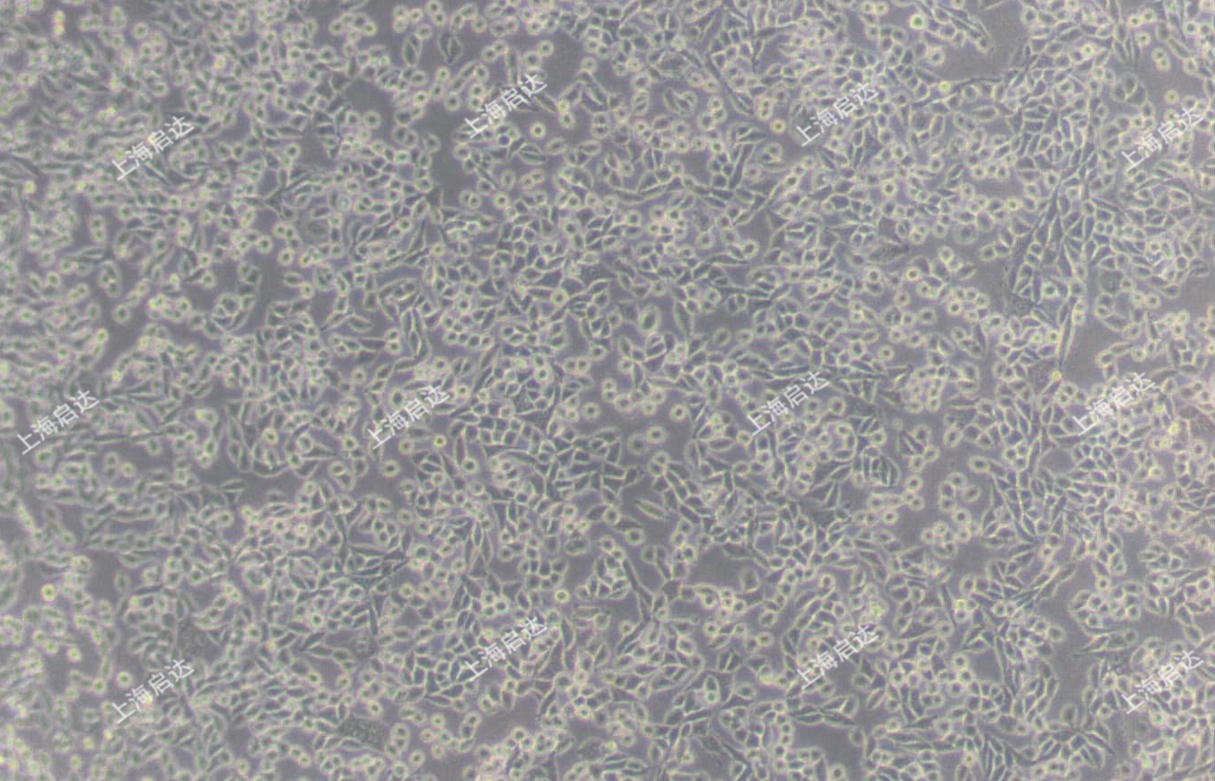 L Wnt-3A小鼠皮下结缔组织细胞