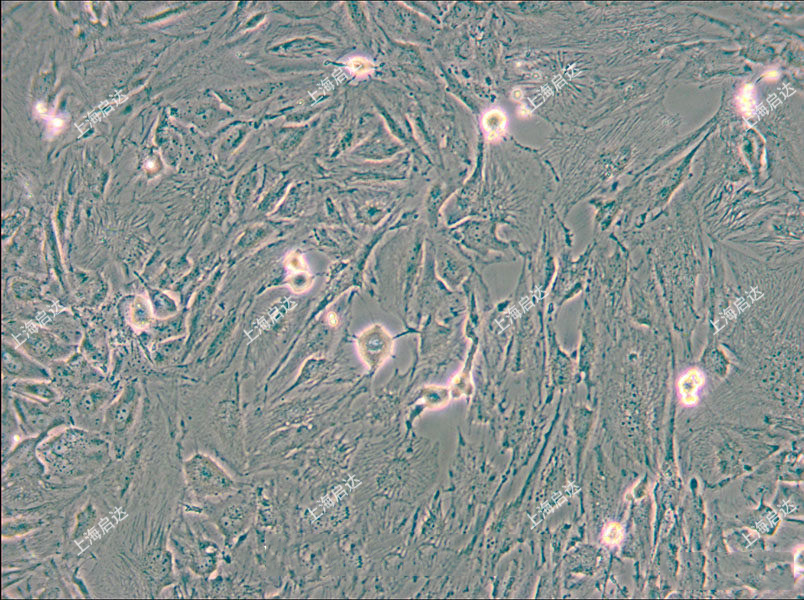 SNU-387人肝癌细胞