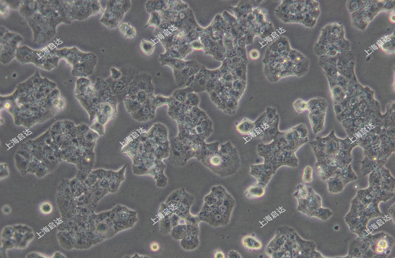 Beta-TC-6小鼠胰岛素瘤胰岛β细胞