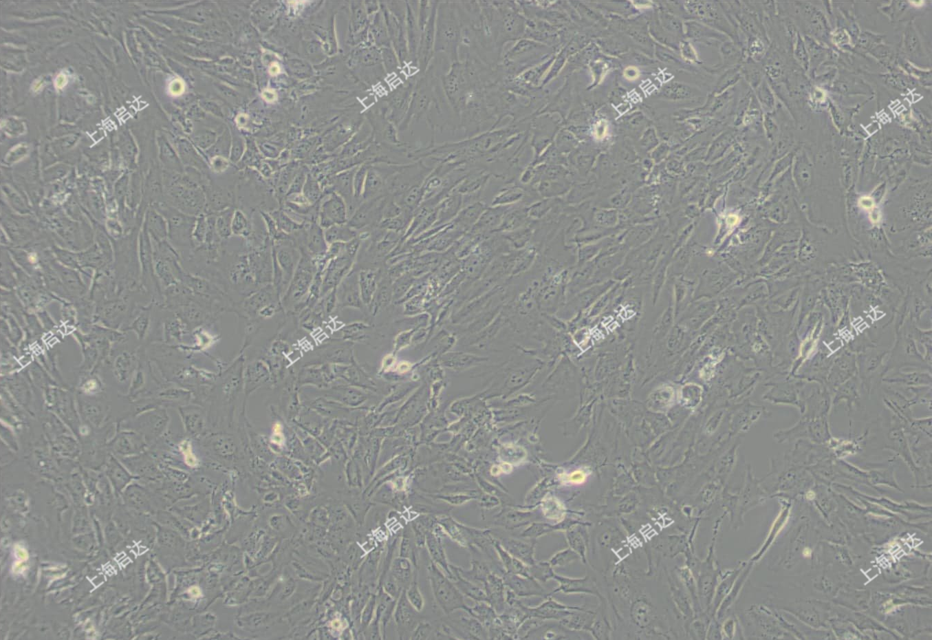 hFOB 1.19人SV40转染成骨细胞