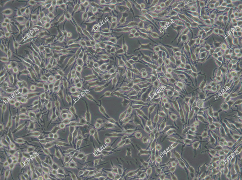 RBL-2H3大鼠嗜碱性粒细胞性白血病细胞