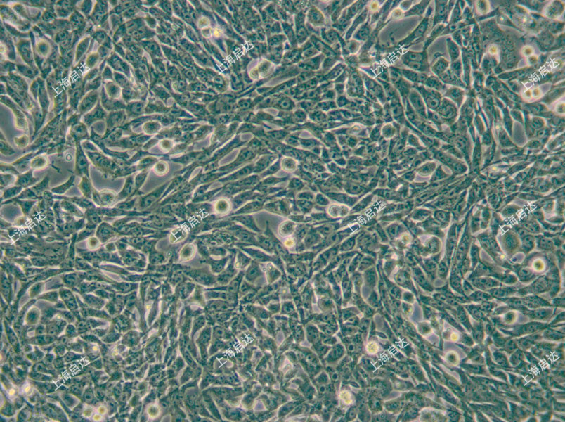 R 1610 [R1610]中国仓鼠肺细胞