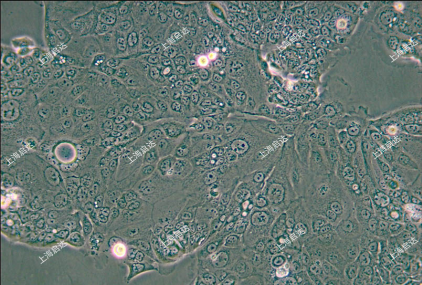 HPAF-II人胰腺癌细胞