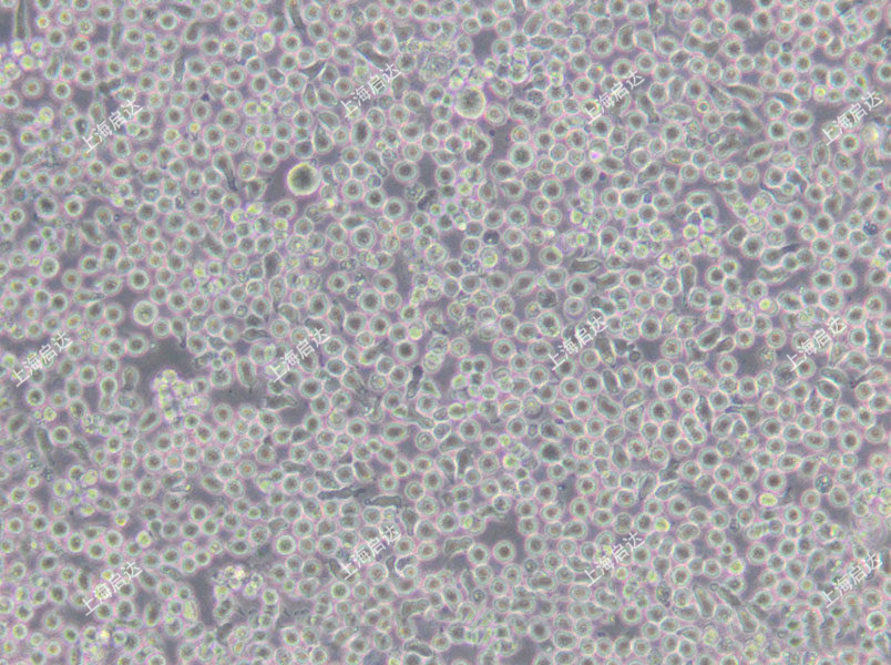 6T-CEM人T细胞白血病细胞