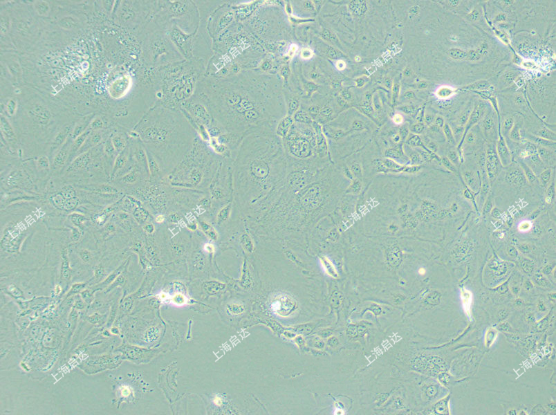 SW626人卵巢腺癌细胞