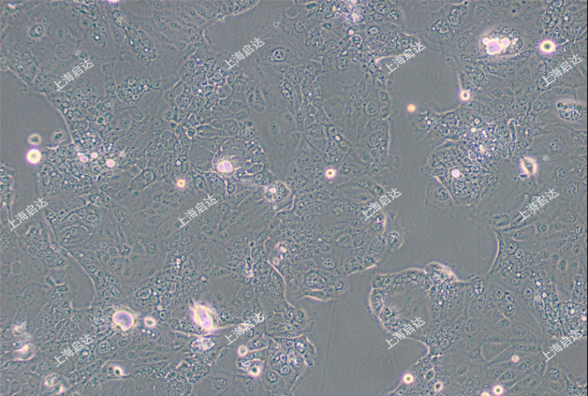 HPAF-II人胰腺癌细胞