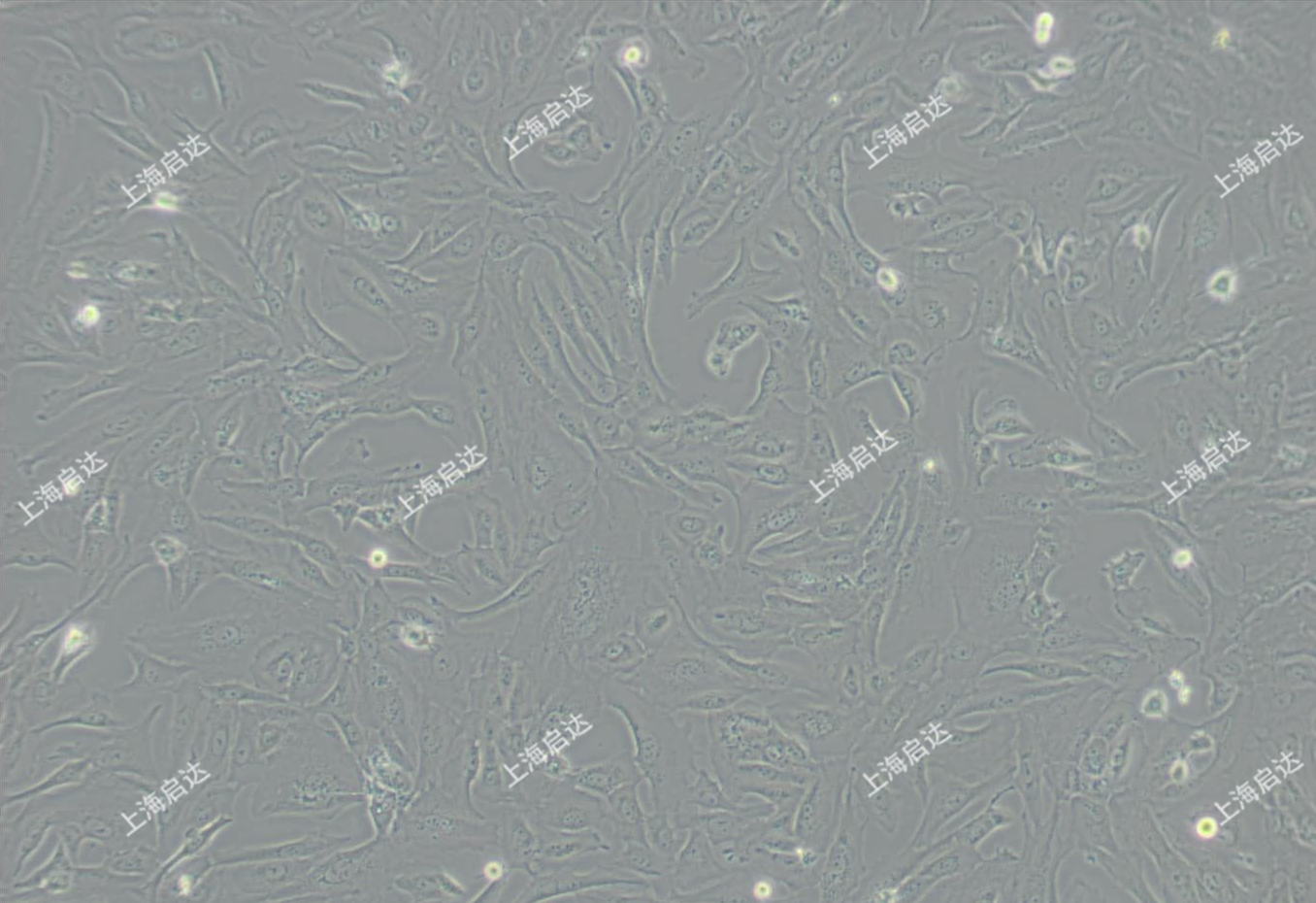 SW1353 [SW 1353, SW-1353]人软骨肉瘤细胞
