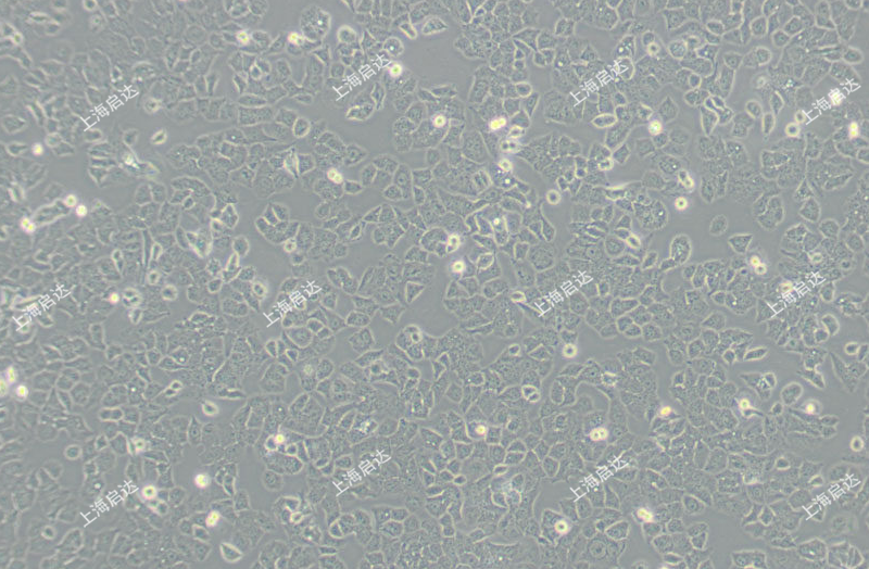 ishikawa(ISK）人子宫内膜癌细胞