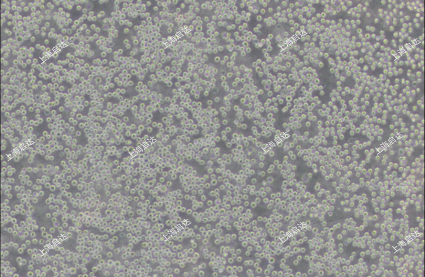 U-937人组织细胞淋巴瘤细胞