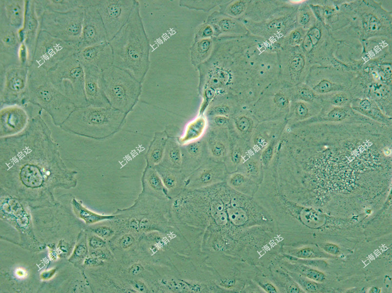 SW626人卵巢腺癌细胞