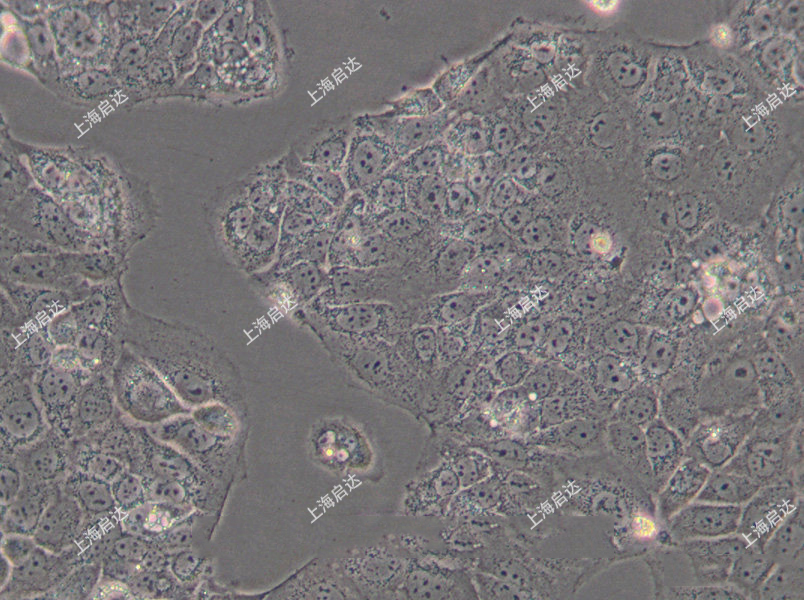 HuH-6人肝母细胞瘤细胞