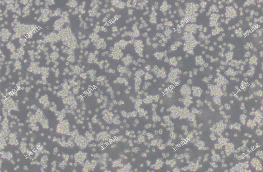 YAC-1小鼠淋巴瘤细胞