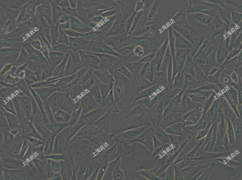 Saos-2人骨肉瘤细胞