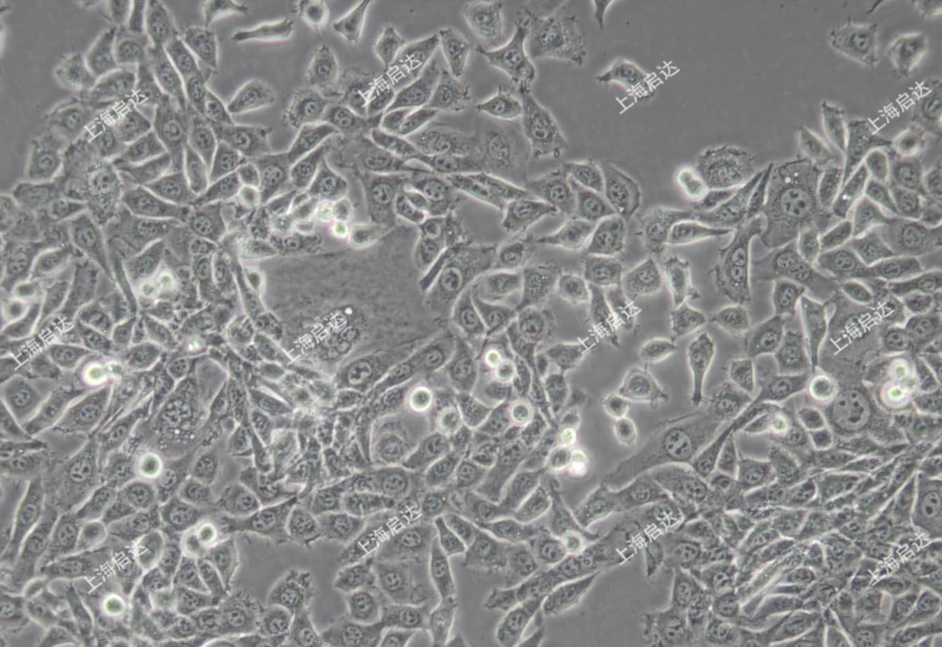 MDA-MB-415人乳腺腺癌细胞