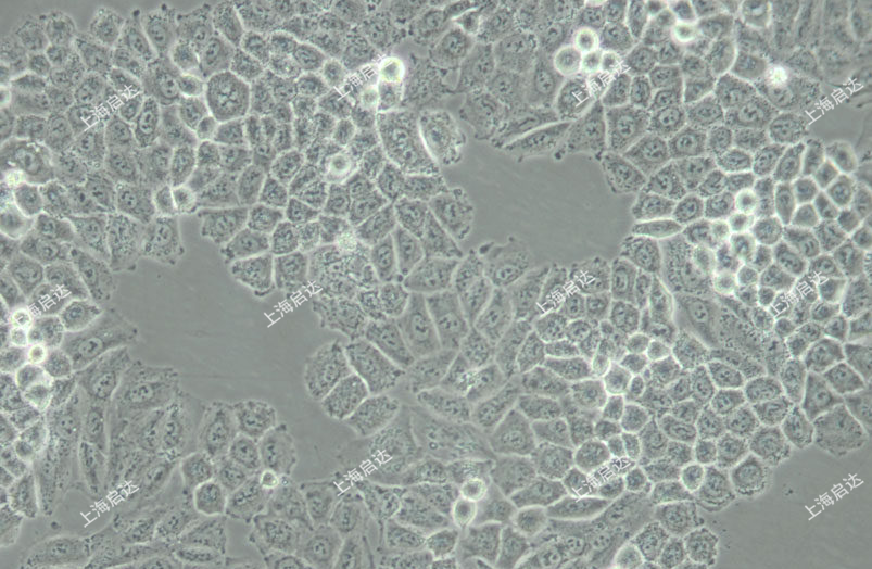 NCI-H460 [H460]人大细胞肺癌细胞