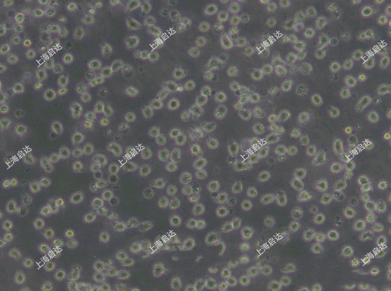 Jeko-1人套细胞淋巴瘤细胞