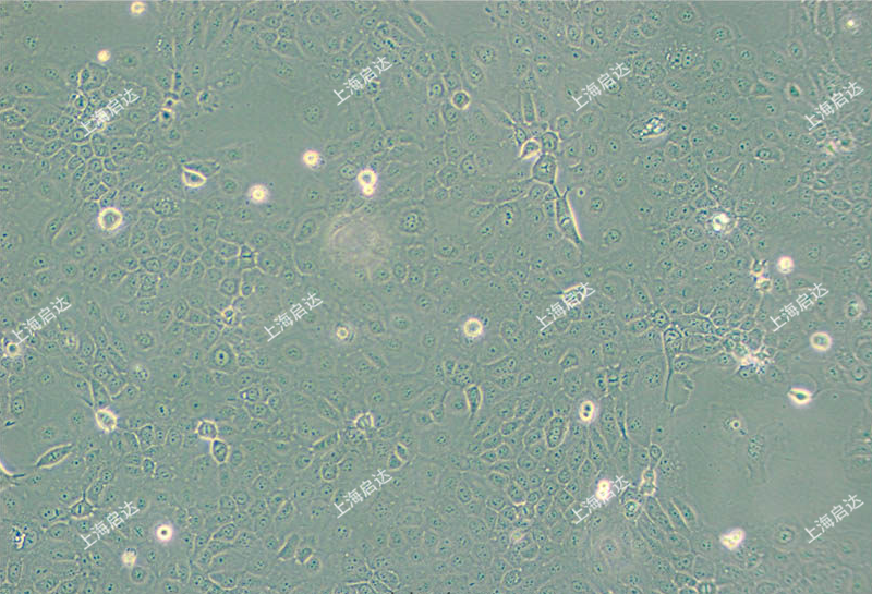 ScaBER人膀胱鳞癌细胞