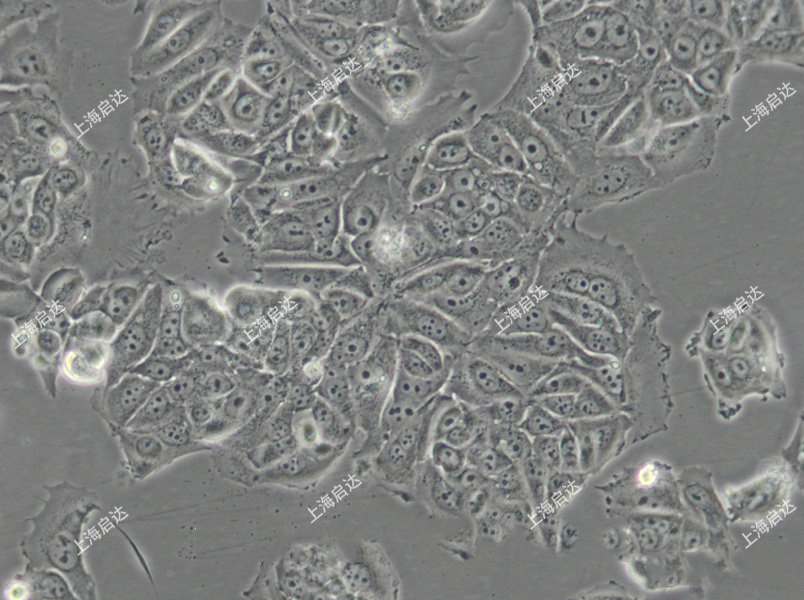 MCF7 [MCF-7]人乳腺癌细胞