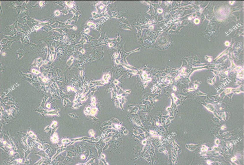 Hs-746T（Hs746T）人胃癌细胞
