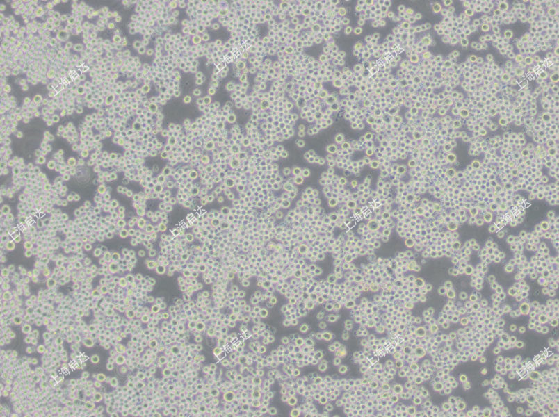 SP2/0小鼠骨髓瘤细胞
