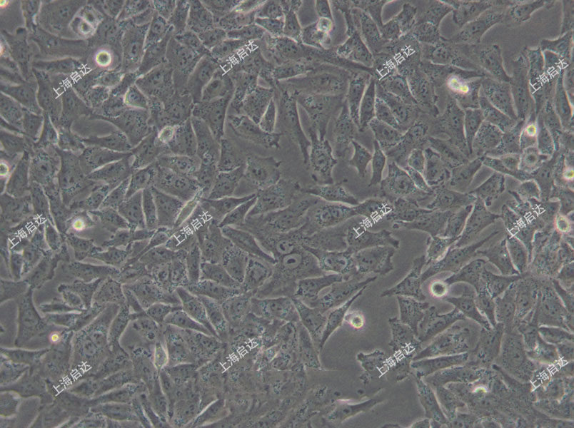 A-375 [A375]人恶性黑色素瘤细胞