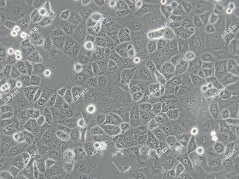 OP9小鼠骨髓基质细胞/小鼠颅盖成纤维细胞
