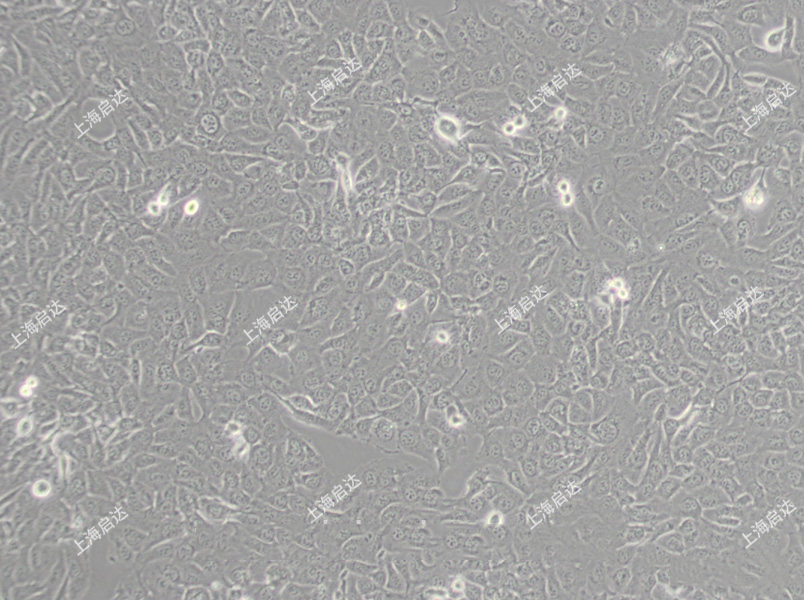 HT-1080 [HT1080]人纤维肉瘤细胞