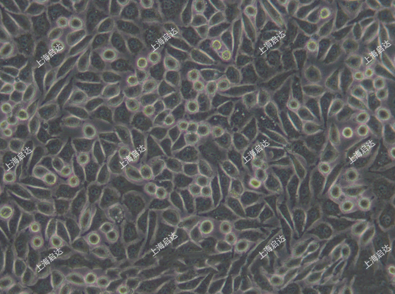 NCTC clone 929 [L cell, L-929, derivative of Strain L]小鼠胚胎成纤维细胞