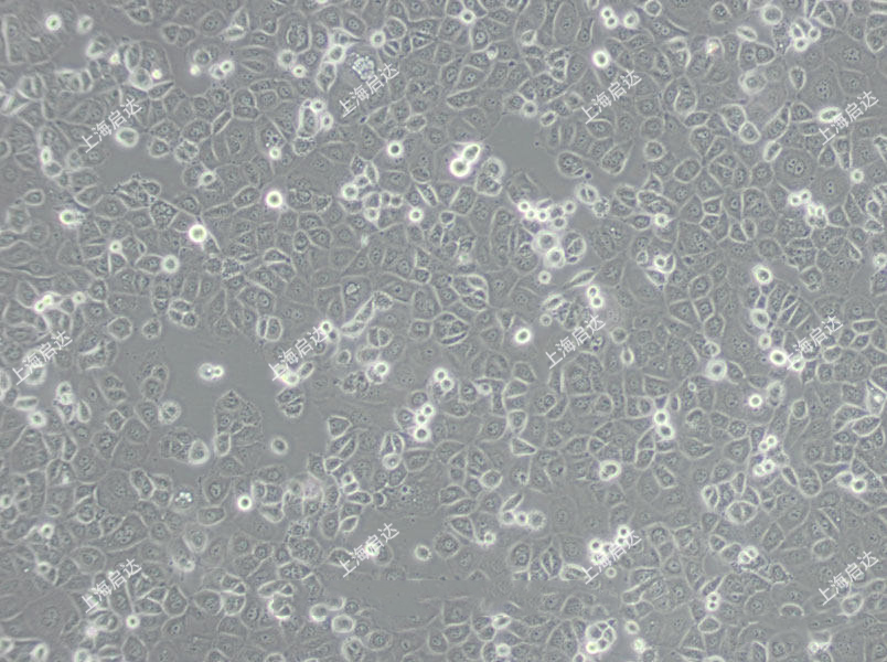 OP9小鼠骨髓基质细胞/小鼠颅盖成纤维细胞