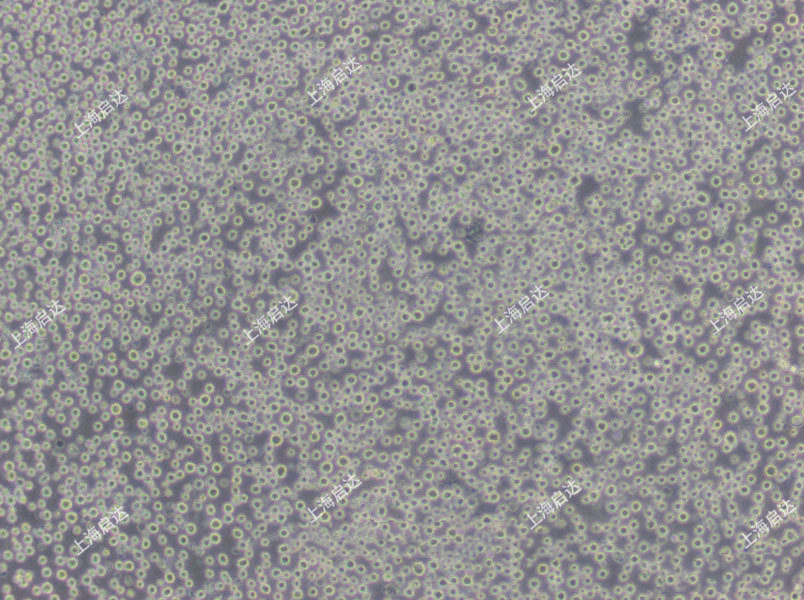 S-180小鼠腹水瘤细胞