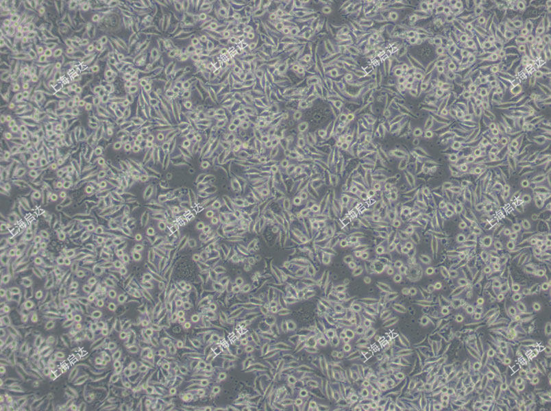 NIH:OVCAR-3 [OVCAR3]人卵巢癌细胞