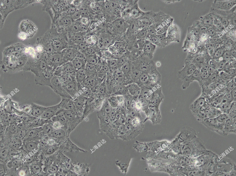 JEG-3人绒毛膜癌细胞