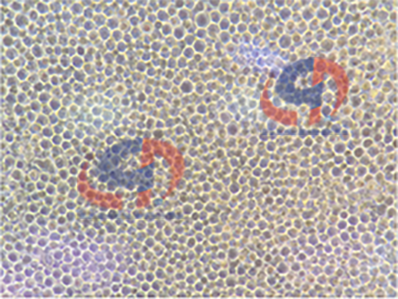 细胞培养无小事（三）贴壁细胞的消化方法