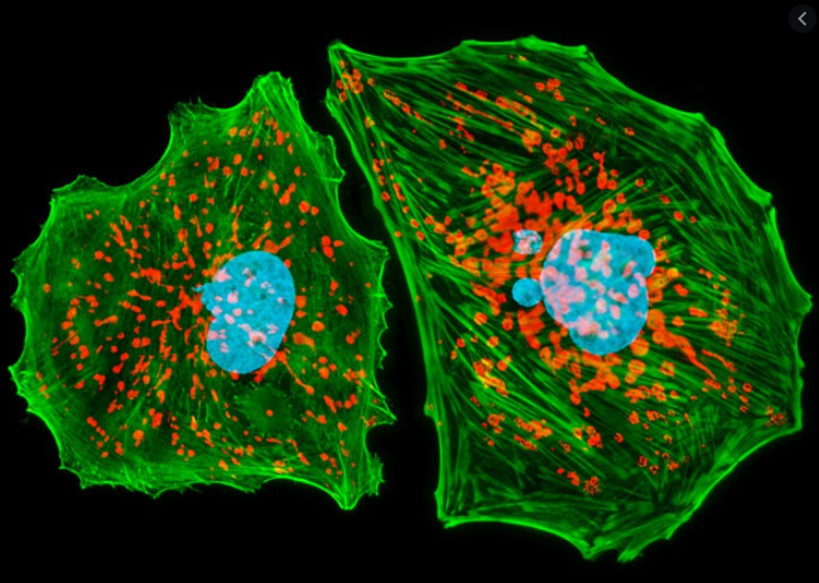 内皮细胞的培养方法和培养基的配制