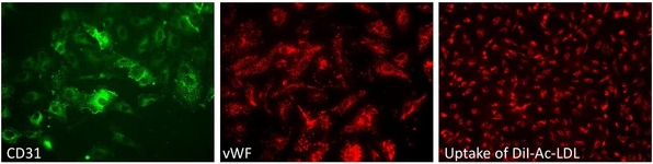 中枢神经系统感染经典文章:B群链球菌如何穿过血脑屏障？