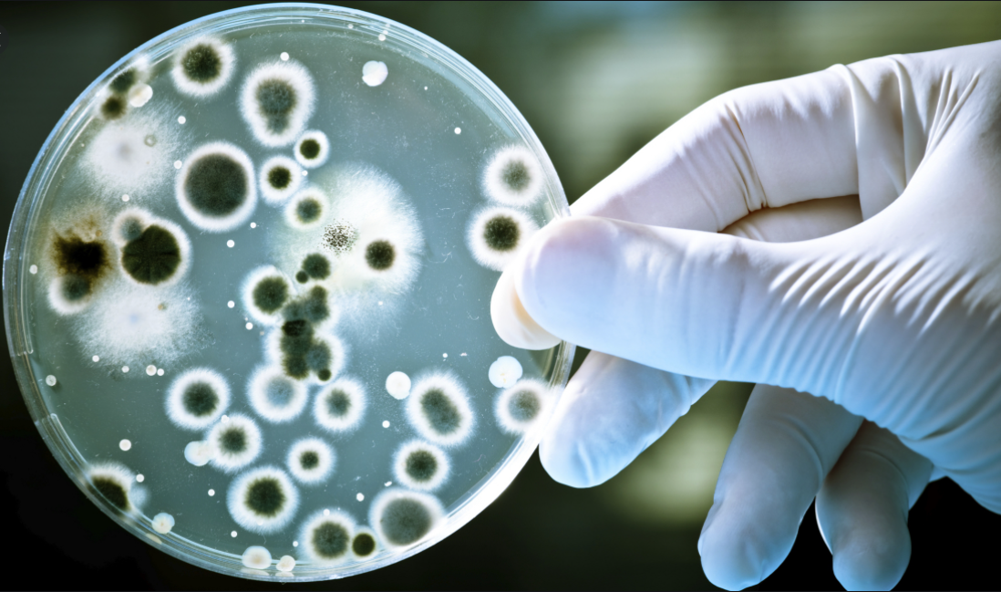 细胞培养之真菌，细胞污染的防治