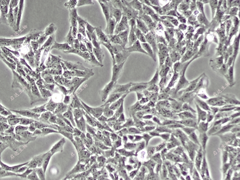 HSCT6大鼠肝星状细胞