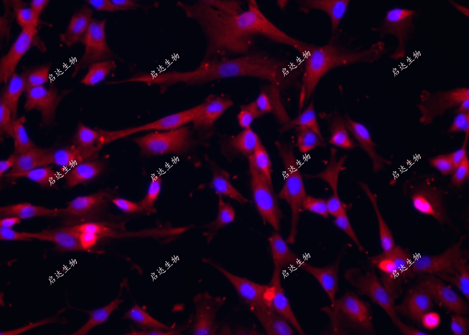 珍藏版-细胞免疫荧光爬片操作步骤