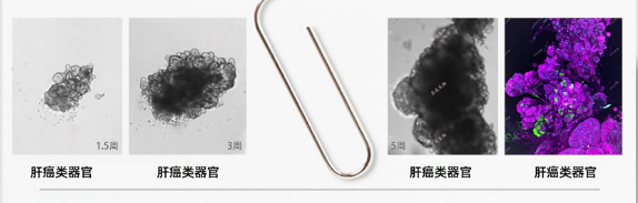 值得关注，类器官操作的Protocol