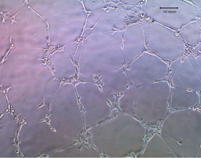 HUVEC成管实验的protocol来啦