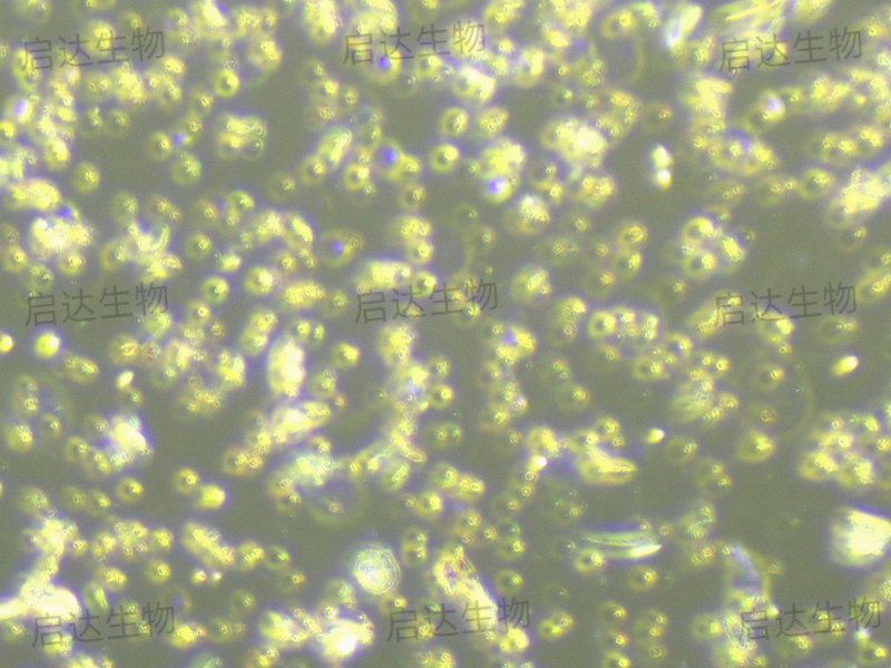 T2(174 x CEM.T2)人淋巴母细胞