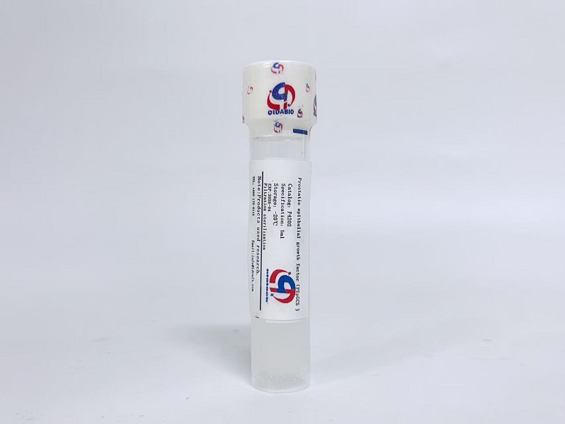 前列腺上皮细胞生长因子PEpGCS